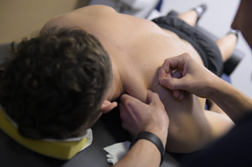 Dry needling Panningen - onze specialisaties - Fysio-Support Peter Slots